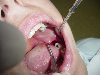 curso taller para odontólogos 02